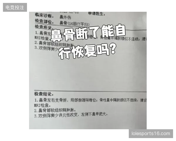 选手鼻骨疑似断裂仍坚持